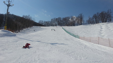 20170305_104127